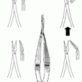 ciseaux-capsulotomie-vannas-tubingen-angle-45